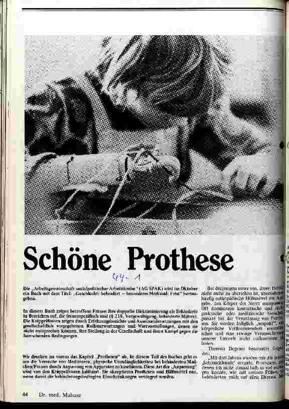 [doc_13245] Schöne Prothese